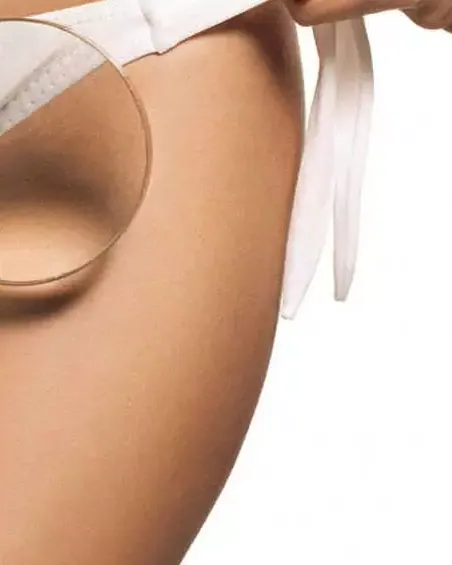 Dış Genital Beyazlatma