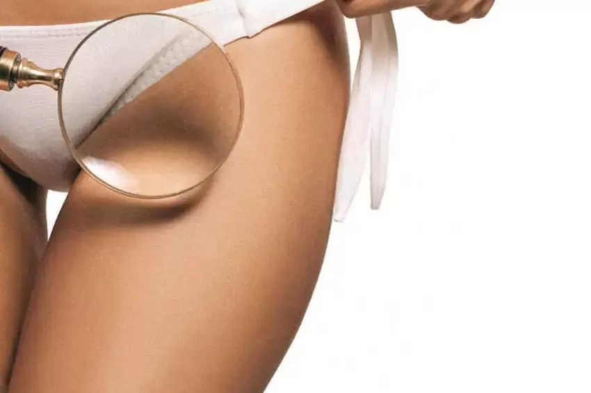 Dış Genital Beyazlatma